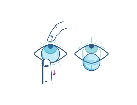 Αφαιρέστε τους φακούς επαφής σας χρησιμοποιώντας το δείκτη για να κατεβάσετε το κάτω άκρο του φακού
